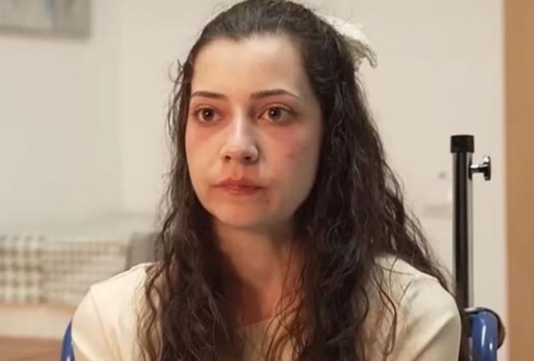 Πέθανε με ευθανασία η 25χρονη Ισπανίδα που είχε πέσει θύμα ομαδικού βιασμού