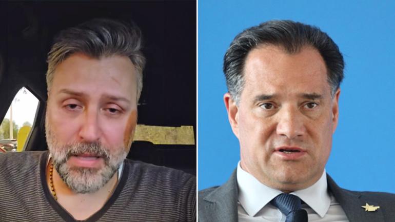 Γιάννης Καλλιάνος: Η περιπέτεια του πατέρα του στο «Αττικόν», η απάντηση Γεωργιάδη και οι εξηγήσεις του νοσοκομείου