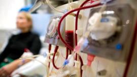 Χαλκιδική: Απροσδιόριστη η αιτία θανάτου 51χρονης που έκανε αιμοκάθαρση σε κλινική - Βρέθηκαν κακώσεις στο σώμα της