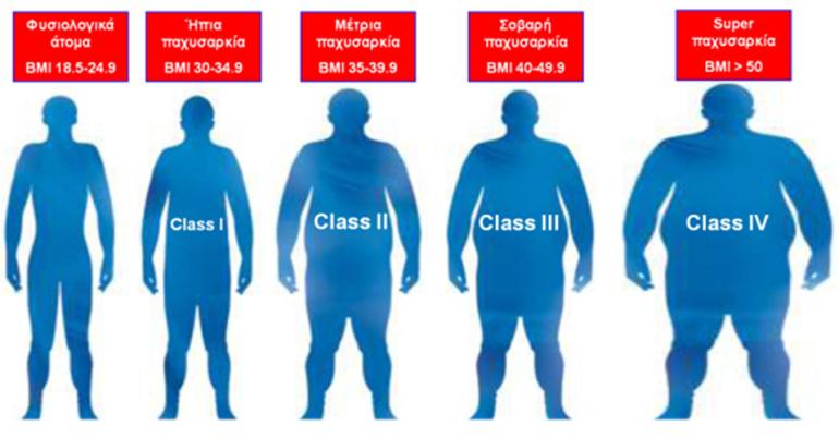 Παχυσαρκία ενηλίκων: 36.360 δικαιούχοι του «Προλαμβάνω» - Το 10% με αναπηρία λόγω της νόσου