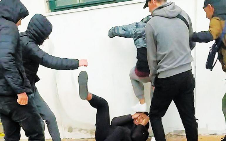 Πάτρα: Aνήλικοι έστησαν καρτέρι στον 15χρονο και τον έστειλαν στο νοσοκομείο με σπασμένη μύτη και σαγόνι
