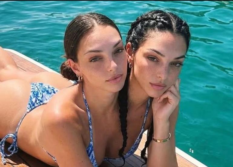 Σιαμαίες «influencers» που απέκτησαν περισσότερους από 280.000 ακόλουθους ήταν απάτη... ΑΙ!