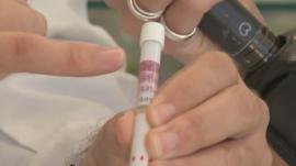 Φαρμακοποιοί Θεσσαλονίκης: Self test ανίχνευσης αλκοόλ στους δρόμους της πόλης για ασφαλέστερη οδήγηση
